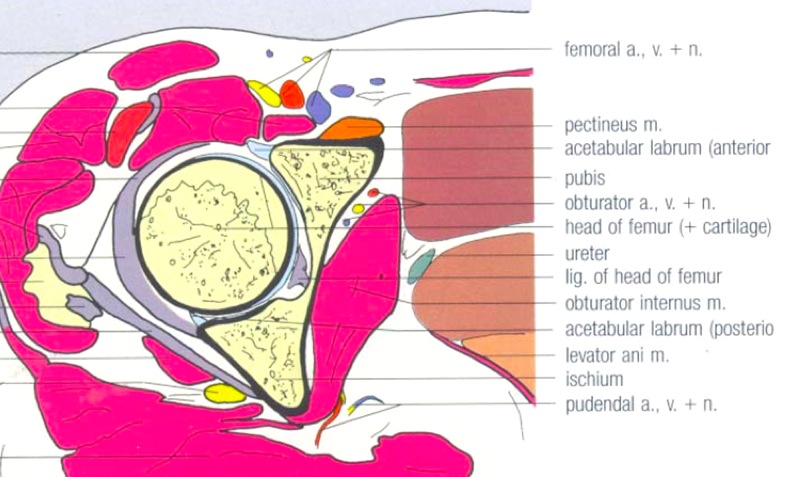 Figure 6 for case Obturator nerve impinge by ganglion cyst